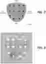 Fig. 08 - GUIDANCE AND TRACKING SYSTEM FOR TEMPLATED AND TARGETED BIOPSY AND TREATMENT