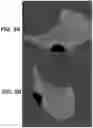 Fig. 09 - GUIDANCE AND TRACKING SYSTEM FOR TEMPLATED AND TARGETED BIOPSY AND TREATMENT