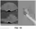 Fig. 10 - GUIDANCE AND TRACKING SYSTEM FOR TEMPLATED AND TARGETED BIOPSY AND TREATMENT