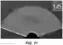 Fig. 11 - GUIDANCE AND TRACKING SYSTEM FOR TEMPLATED AND TARGETED BIOPSY AND TREATMENT