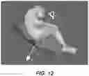 Fig. 12 - GUIDANCE AND TRACKING SYSTEM FOR TEMPLATED AND TARGETED BIOPSY AND TREATMENT