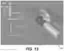 Fig. 13 - GUIDANCE AND TRACKING SYSTEM FOR TEMPLATED AND TARGETED BIOPSY AND TREATMENT