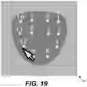 Fig. 19 - GUIDANCE AND TRACKING SYSTEM FOR TEMPLATED AND TARGETED BIOPSY AND TREATMENT
