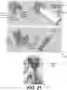 Fig. 21 - GUIDANCE AND TRACKING SYSTEM FOR TEMPLATED AND TARGETED BIOPSY AND TREATMENT