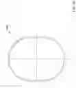 Fig. 33 - BIOPSY DEVICE FOR USE WITH ENDOSCOPE