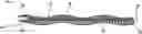 Fig. 01 - MICROGRAFT FOR THE TREATMENT OF INTRACRANIAL ANEURYSMS AND METHOD FOR USE