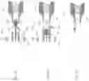 Fig. 06 - MICROGRAFT FOR THE TREATMENT OF INTRACRANIAL ANEURYSMS AND METHOD FOR USE