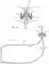 Fig. 09 - Systems, devices, and methods for closing an abdominal wall defect