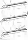 Fig. 11 - Systems, devices, and methods for closing an abdominal wall defect