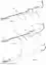 Fig. 13 - Systems, devices, and methods for closing an abdominal wall defect