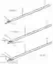 Fig. 14 - Systems, devices, and methods for closing an abdominal wall defect