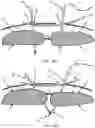Fig. 27 - Systems, devices, and methods for closing an abdominal wall defect