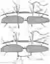 Fig. 33 - Systems, devices, and methods for closing an abdominal wall defect