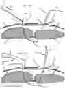 Fig. 34 - Systems, devices, and methods for closing an abdominal wall defect