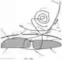 Fig. 35 - Systems, devices, and methods for closing an abdominal wall defect