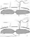Fig. 38 - Systems, devices, and methods for closing an abdominal wall defect
