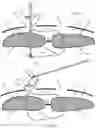 Fig. 41 - Systems, devices, and methods for closing an abdominal wall defect