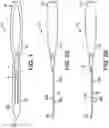 Fig. 02 - Force measuring joint distraction lever