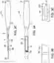 Fig. 03 - Force measuring joint distraction lever