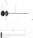 Fig. 03 - ORGAN RETRACTOR