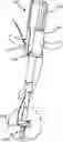 Fig. 01 - SHUTTLE CABLE TRANSPORTING DEVICE AND METHOD