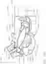 Fig. 132 - Surgical instrument comprising a stowed closure actuator stop
