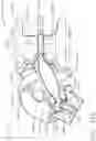 Fig. 130 - Surgical instrument comprising a staged voltage regulation start-up system