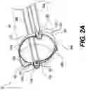 Fig. 03 - Fastening devices and related methods of use