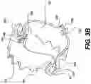 Fig. 06 - Fastening devices and related methods of use