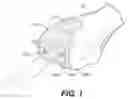 Fig. 02 - ROBOTIC SURGICAL SYSTEM WITH CUT SELECTION LOGIC