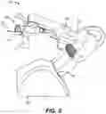Fig. 06 - ROBOTIC SURGICAL SYSTEM WITH CUT SELECTION LOGIC
