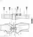 Fig. 02 - System for total knee replacement
