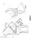 Fig. 03 - System for total knee replacement