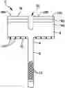Fig. 01 - Chevron osteotomy tools and methods
