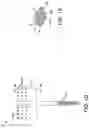Fig. 04 - Chevron osteotomy tools and methods