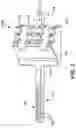 Fig. 06 - Chevron osteotomy tools and methods