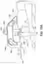 Fig. 16 - Chevron osteotomy tools and methods