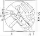 Fig. 18 - Chevron osteotomy tools and methods