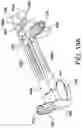 Fig. 19 - Chevron osteotomy tools and methods