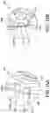 Fig. 23 - Chevron osteotomy tools and methods
