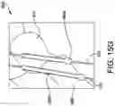 Fig. 26 - Chevron osteotomy tools and methods