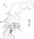 Fig. 29 - Chevron osteotomy tools and methods