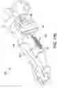 Fig. 30 - Chevron osteotomy tools and methods