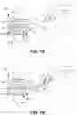 Fig. 08 - Lithotripsy Probes and Methods for Performing Lithotripsy