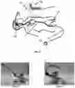 Fig. 07 - Electrically controllable surgical tools