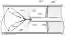 Fig. 01 - Retrograde Blood Flow Occlusion Flushing Device