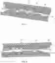 Fig. 06 - Atherectomy devices and methods