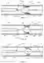 Fig. 08 - Atherectomy devices and methods