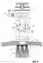 Fig. 06 - Surgical access device with fixation mechanism and illumination mechanism