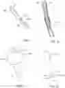 Fig. 08 - Distal Tips of Surgical Tools and Related Methods